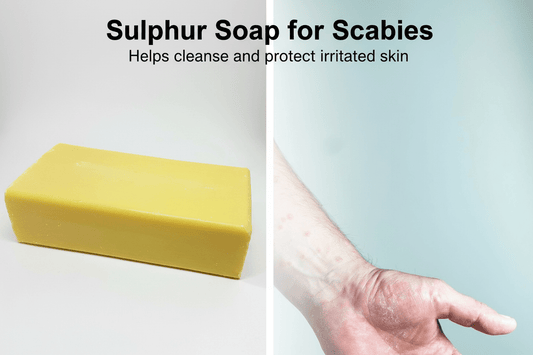 10% Sulphur Soap (200g) for Acne, Rosacea, Eczema & Scabies Relief - Herbalshire Handmade Herbal Products