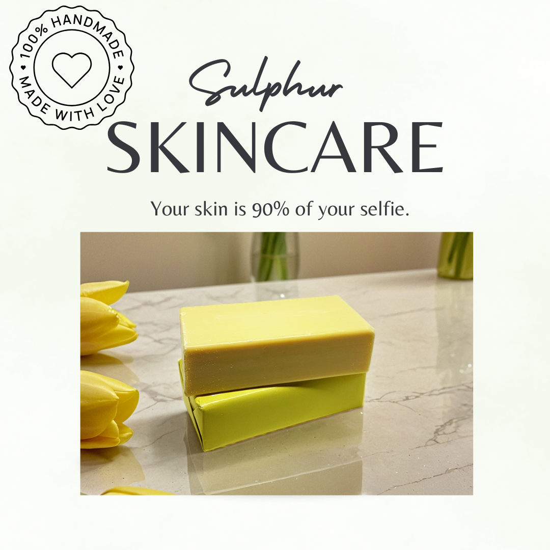 Sulphur Soap Bar 200g – Natural Acne, Rosacea, Eczema & Fungal Treatment UK