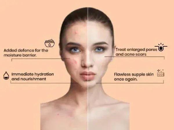 Ammuri Retinol Apple Stem Cell Age Reverse Cream - Herbalshire Handmade Herbal Products
