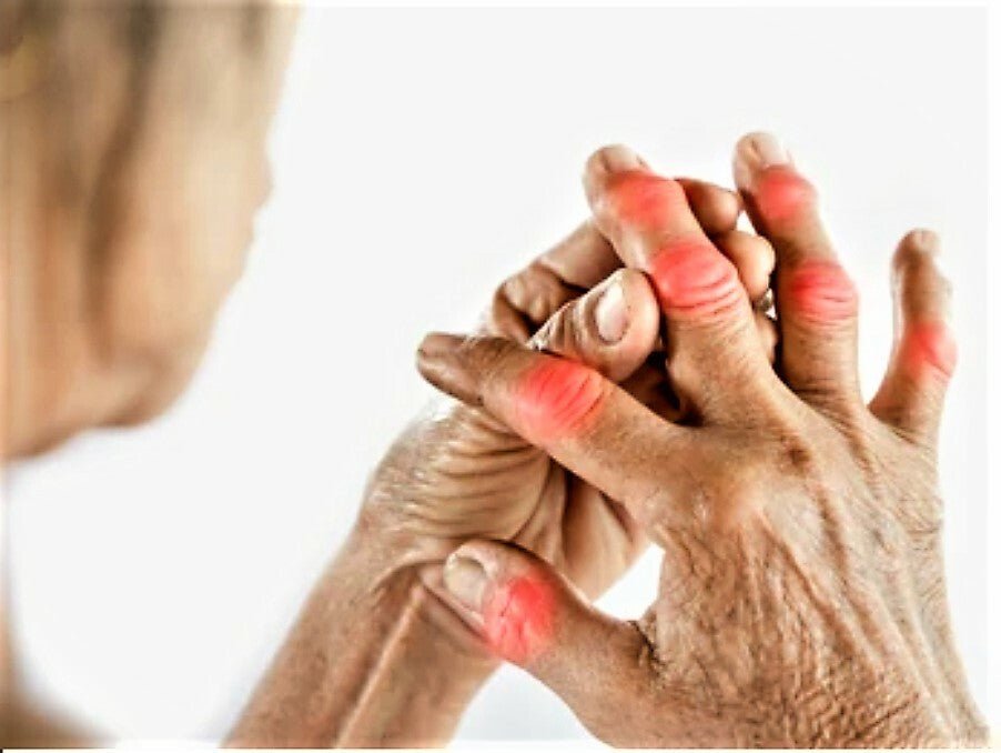 Arthritis Pain Relief Cream Joint Knee Hip Osteoarthritis Ointment Fast Acting - Herbalshire Handmade Herbal Products