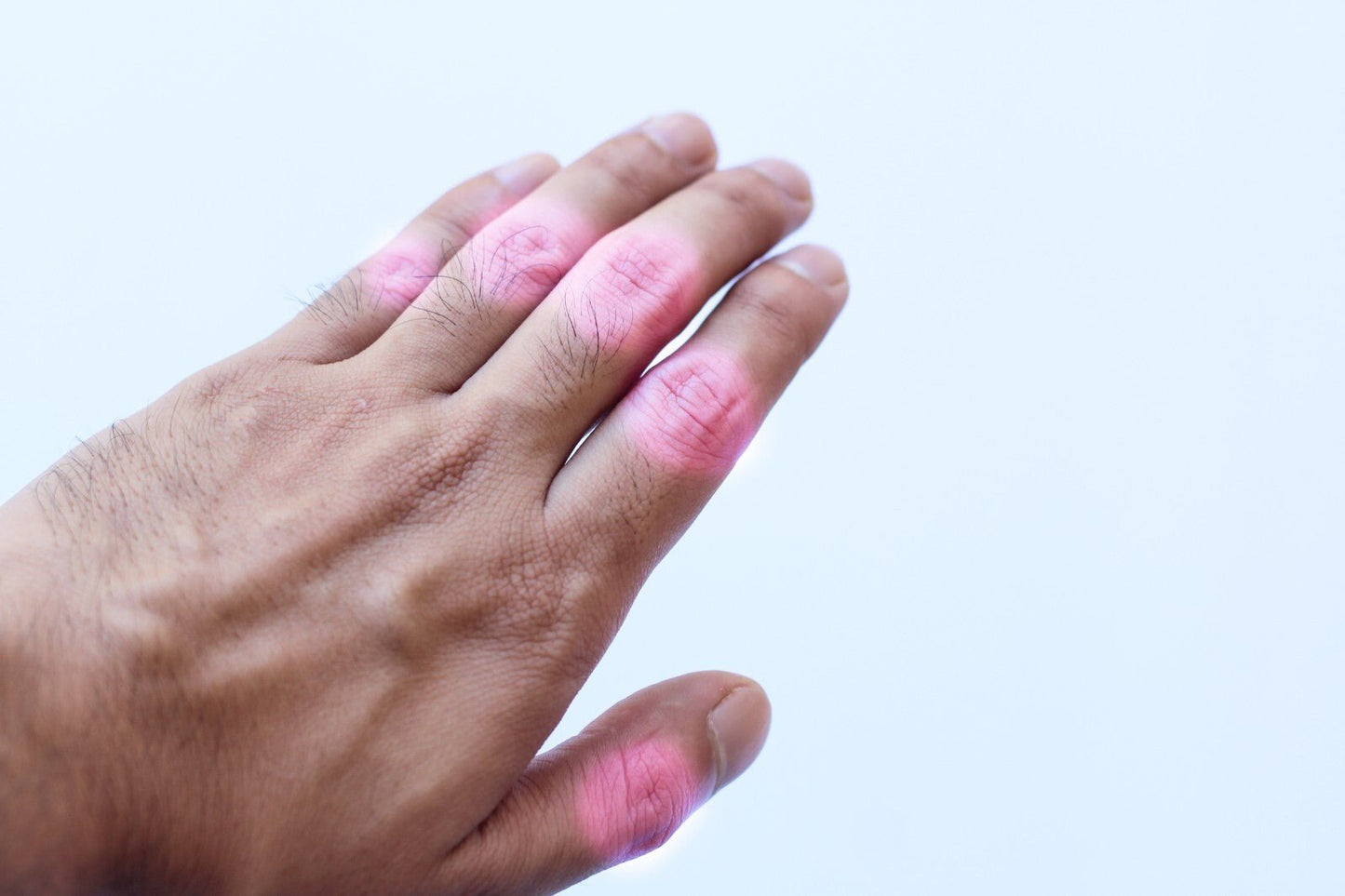 Arthritis & Rheumatism Ointment Reduce Inflammation Enhance Mobility Handmade - Herbalshire Handmade Herbal Products