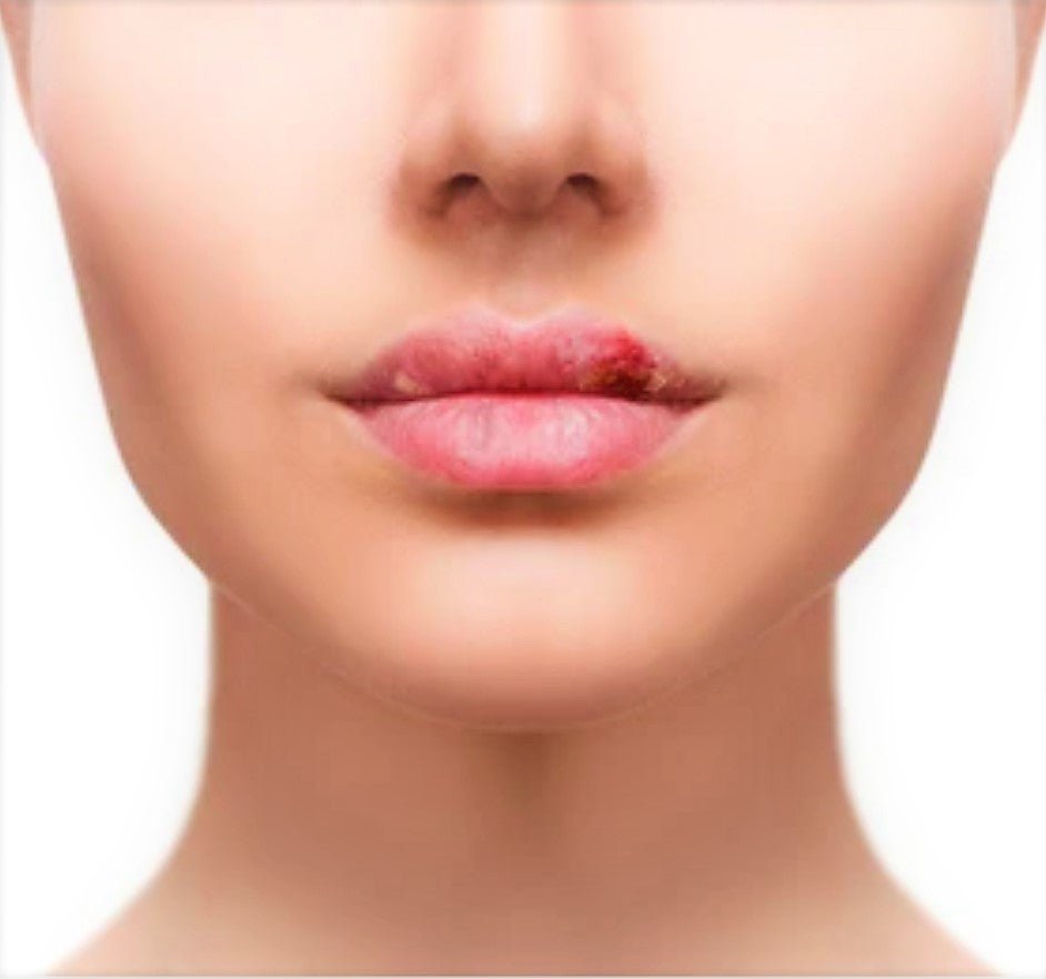 Calendula Ointment UK 60ml - Natural Healing for Cuts, Burns, Acne, and Stretch - Herbalshire Handmade Herbal Products