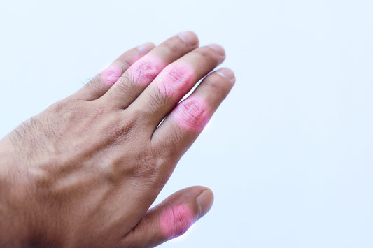 Handmade Arthritis & Rheumatism Ointment - 60ml Herbal Balm for Inflammation & - Herbalshire Handmade Herbal Products