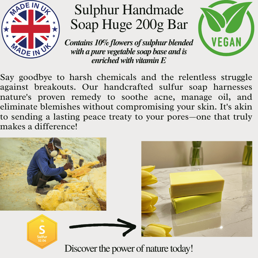 Sulphur Soap Bar 200g – Natural Acne, Rosacea, Eczema & Fungal Treatment UK - Herbalshire Handmade Herbal Products