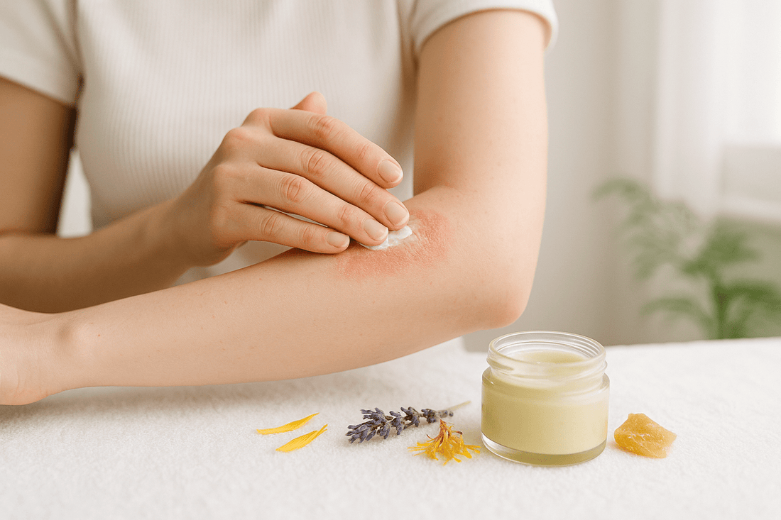 Causes of Itchy Skin & How to Treat Them Naturally - Herbalshire Handmade Herbal Products