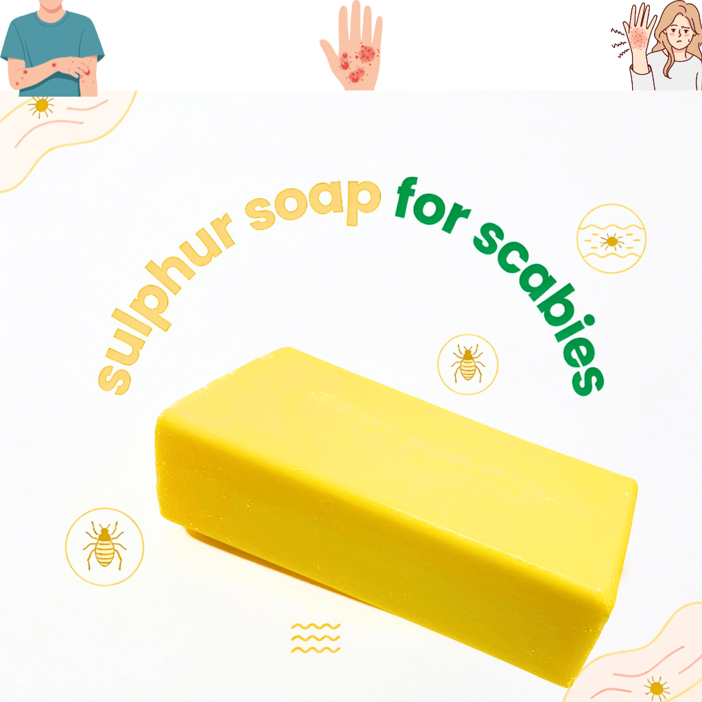 10% Sulphur Soap (200g) for Acne, Rosacea, Eczema & Scabies Relief - Herbalshire Handmade Herbal Products