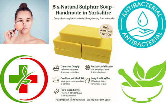 5 x Sulphur Soap Bars – Best Sulphur Acne Treatment for Eczema, Scabies & Skin Fungus – Handmade in the UK – Only £24.99 with Free P&P
