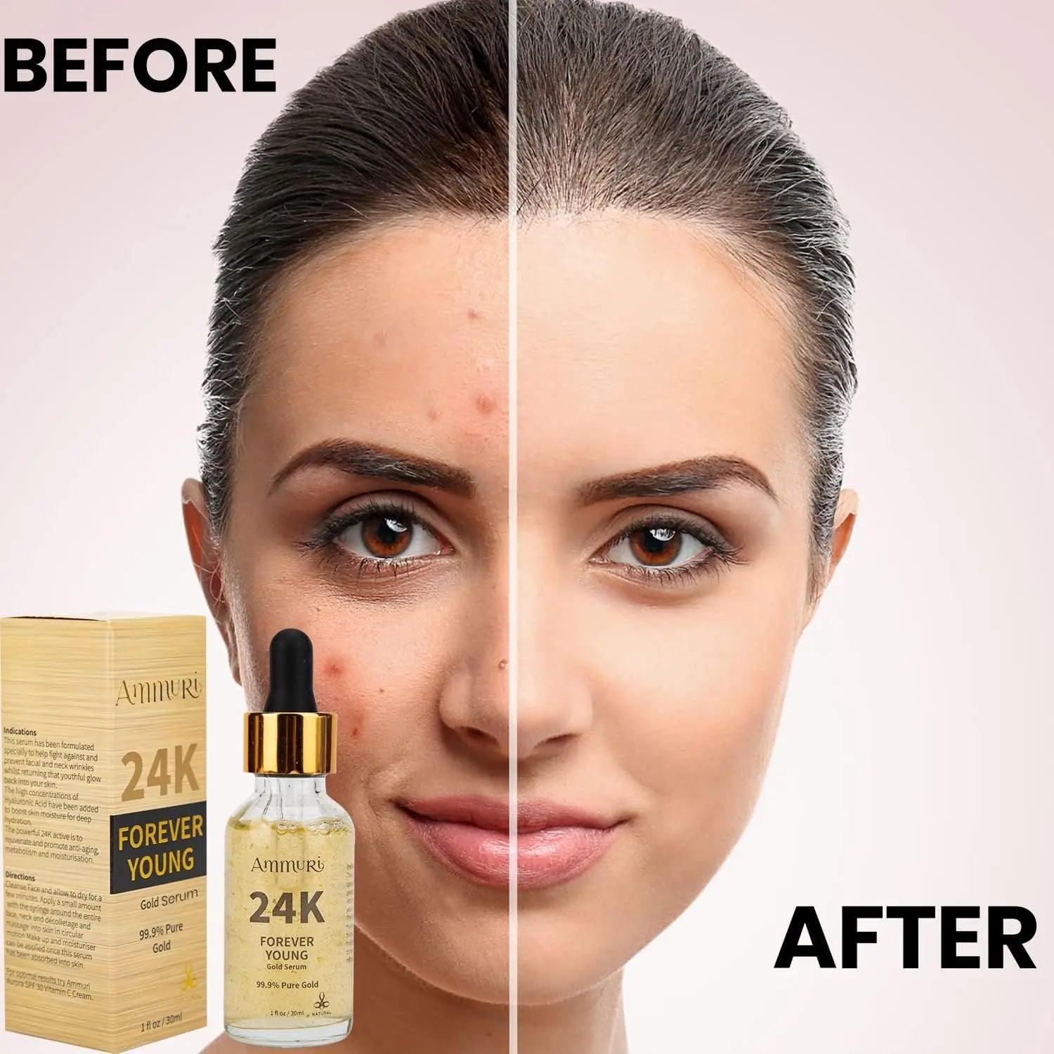 Ammuri 24K Gold Face Serum Anti - Ageing Collagen Booster – Better Than Charlotte Tilbury! - Herbalshire Handmade Herbal Products