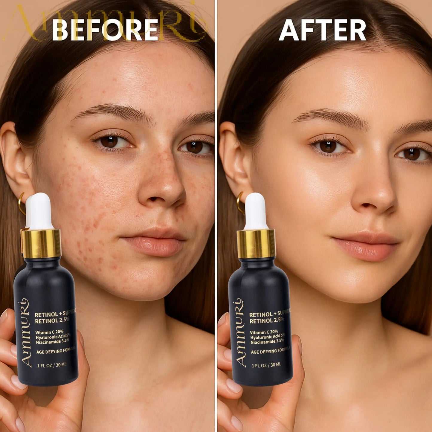 Ammuri 2.5% Retinol Serum - Gentle Anti - Aging Treatment - Herbalshire Handmade Herbal Products