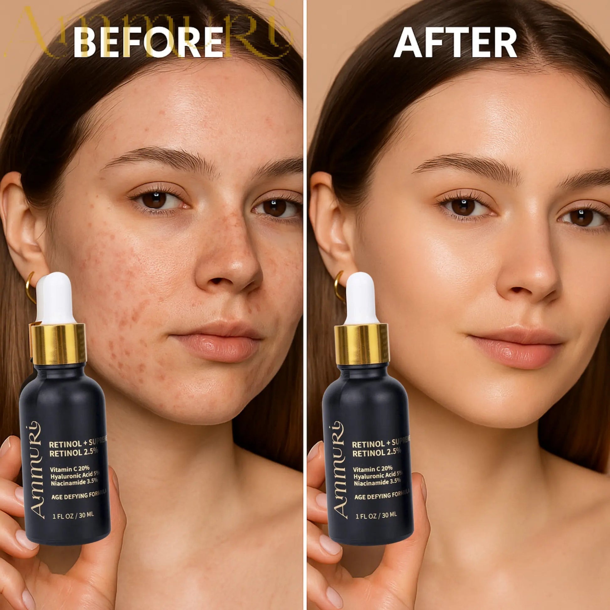 Ammuri 2.5% Retinol Serum - Gentle Anti - Aging Treatment - Herbalshire Handmade Herbal Products