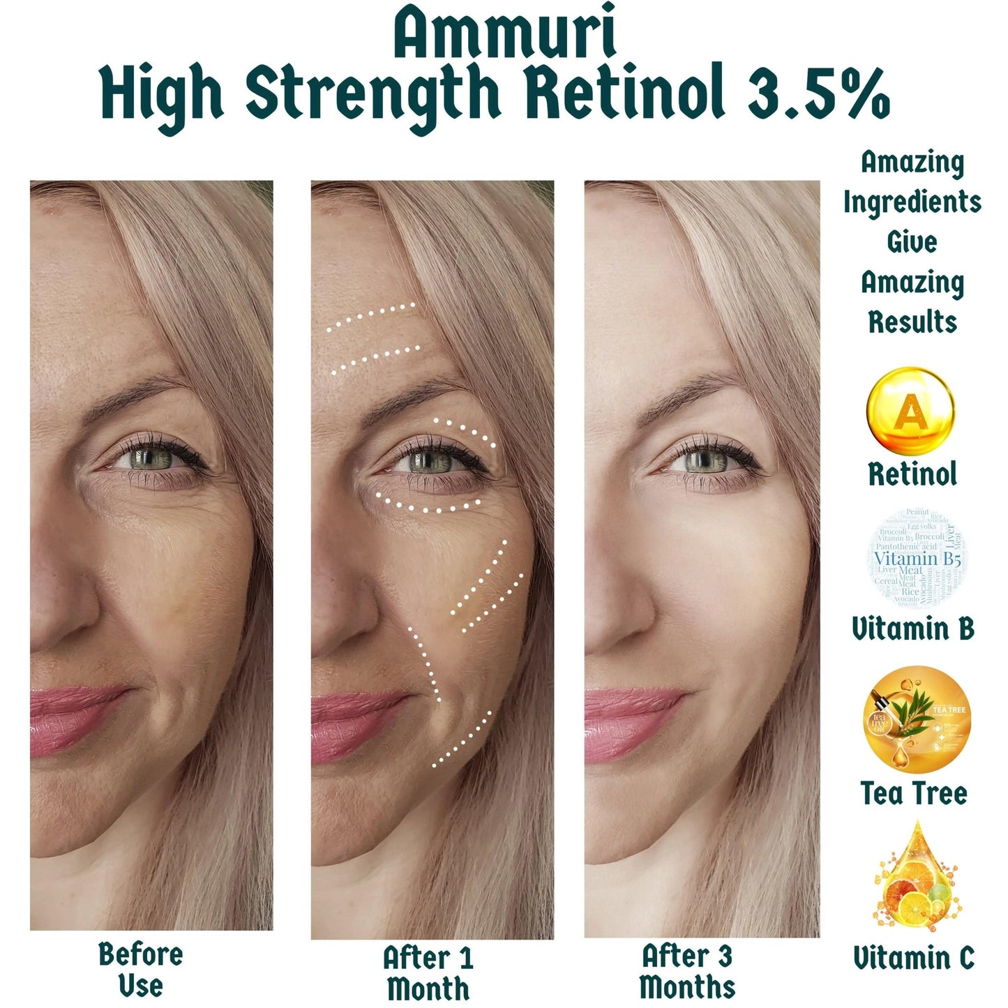Ammuri 3.5% Retinol High Strength Face Serum – Anti - Ageing Formula - Herbalshire Handmade Herbal Products