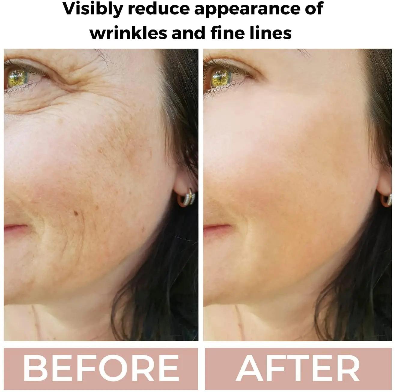 Ammuri 3.5% Retinol High Strength Face Serum – Anti - Ageing Formula - Herbalshire Handmade Herbal Products