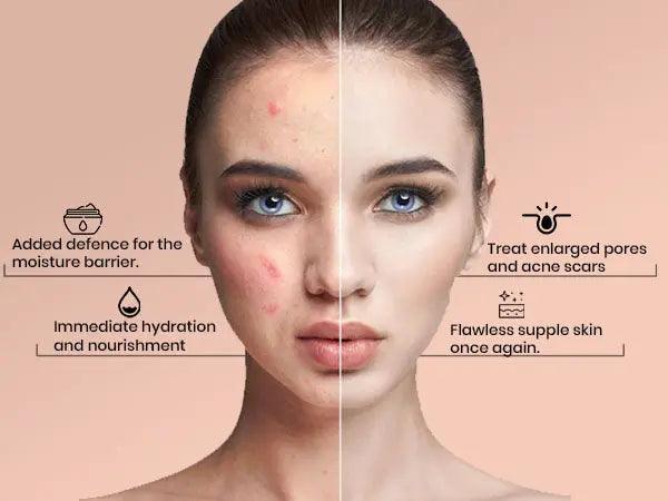 Ammuri Advanced Retinol 2.5% + Q10 Anti - Aging Cream - Herbalshire Handmade Herbal Products