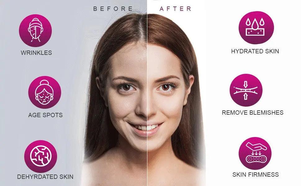 AmmuRi Age Reverse Serum – Advanced Botox Alternative Anti - Aging Formula – 30ml - Herbalshire Handmade Herbal Products