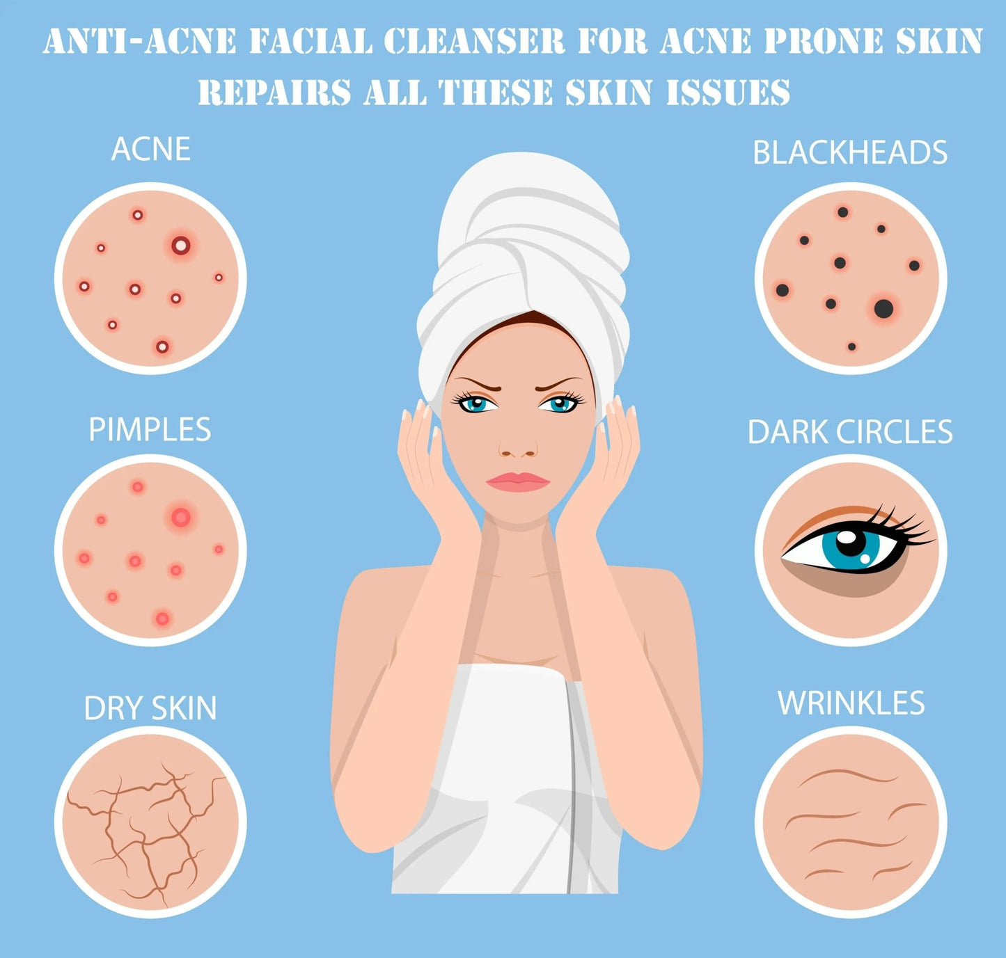 Ammuri Anti Acne Facial Cleanser for Acne Prone Skin - Herbalshire Handmade Herbal Products