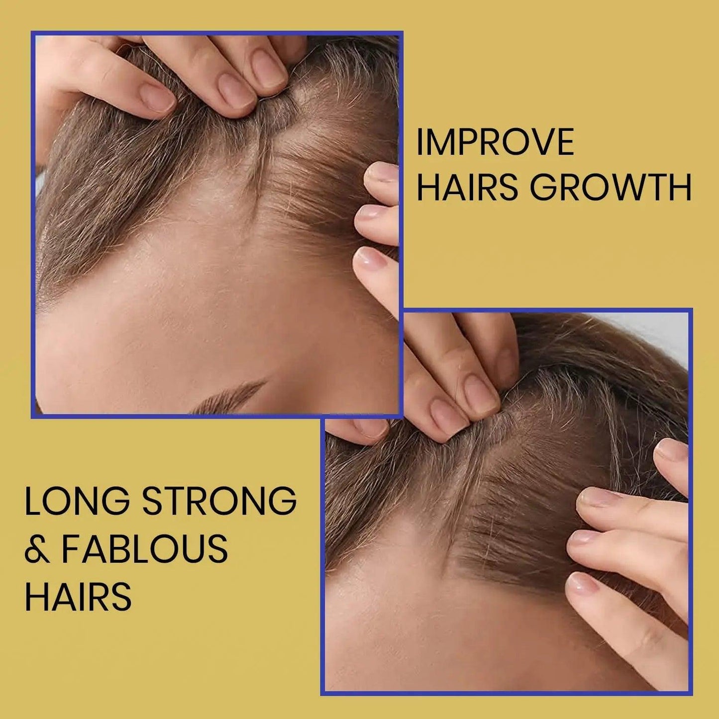 Ammuri Biotin Shampoo for Thicker Hair & Growth - Herbalshire Handmade Herbal Products