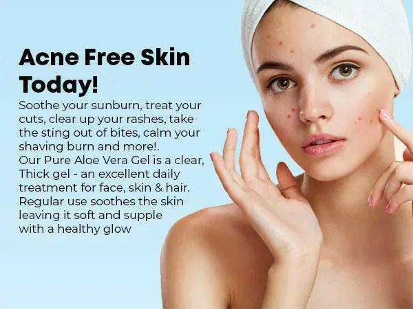 Ammuri Organic Aloe Vera Gel for All Skin Types - Herbalshire Handmade Herbal Products