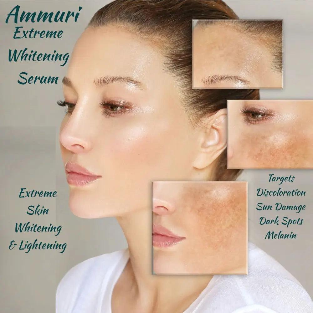 Ammuri Premium Whitening & Brightening Serum 30ml – Kojic Acid, Tranexamic Acid, Alpha Arbutin, Vitamin C & Hyaluronic Acid | Dark Spot Corrector & Hyperpigmentation Treatment – Korean Face Serum - Herbalshire Handmade Herbal Products