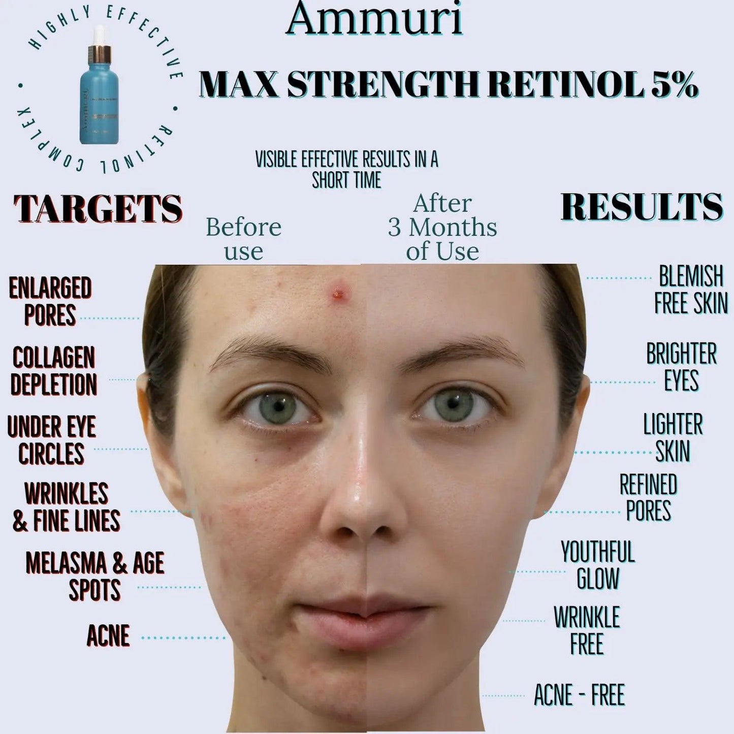 Ammuri Retinol 5% Serum for Anti - Ageing Skin Revitalization - Herbalshire Handmade Herbal Products