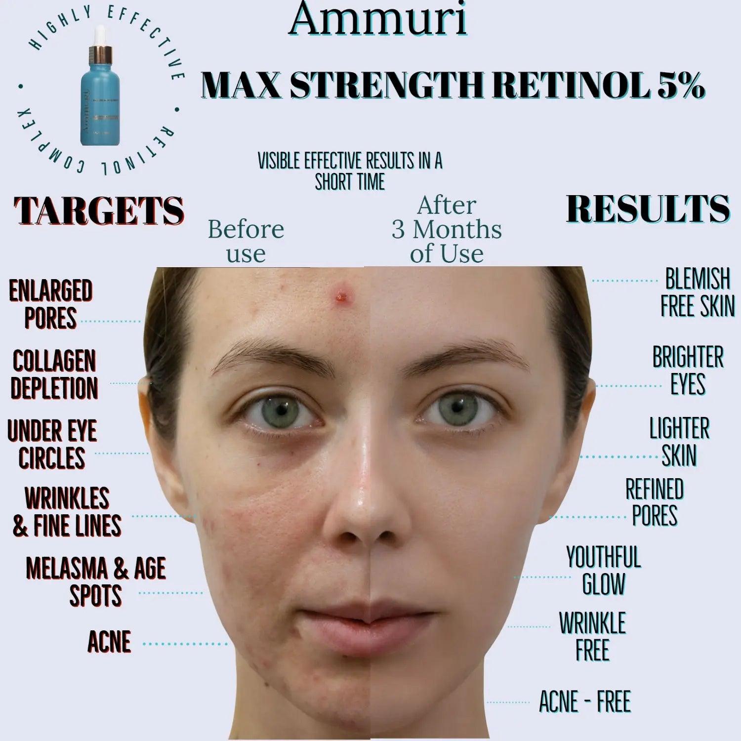 Ammuri Retinol 5% Serum for Anti - Ageing Skin Revitalization - Herbalshire Handmade Herbal Products