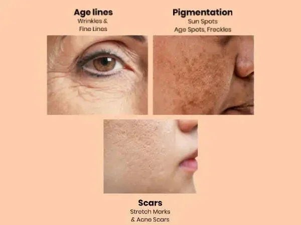 Ammuri Retinol Apple Stem Cell Age Reverse Cream - Herbalshire Handmade Herbal Products