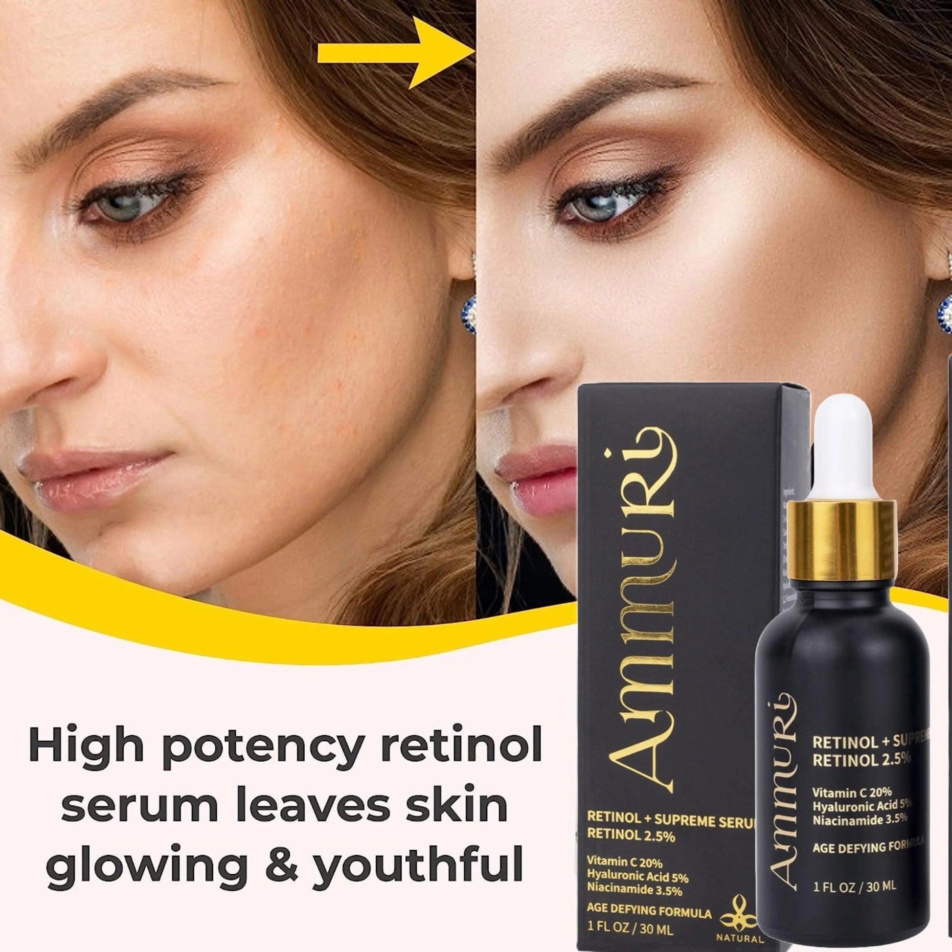 Ammuri Retinol Supreme Serum for Anti - Ageing Skin Care - Herbalshire Handmade Herbal Products