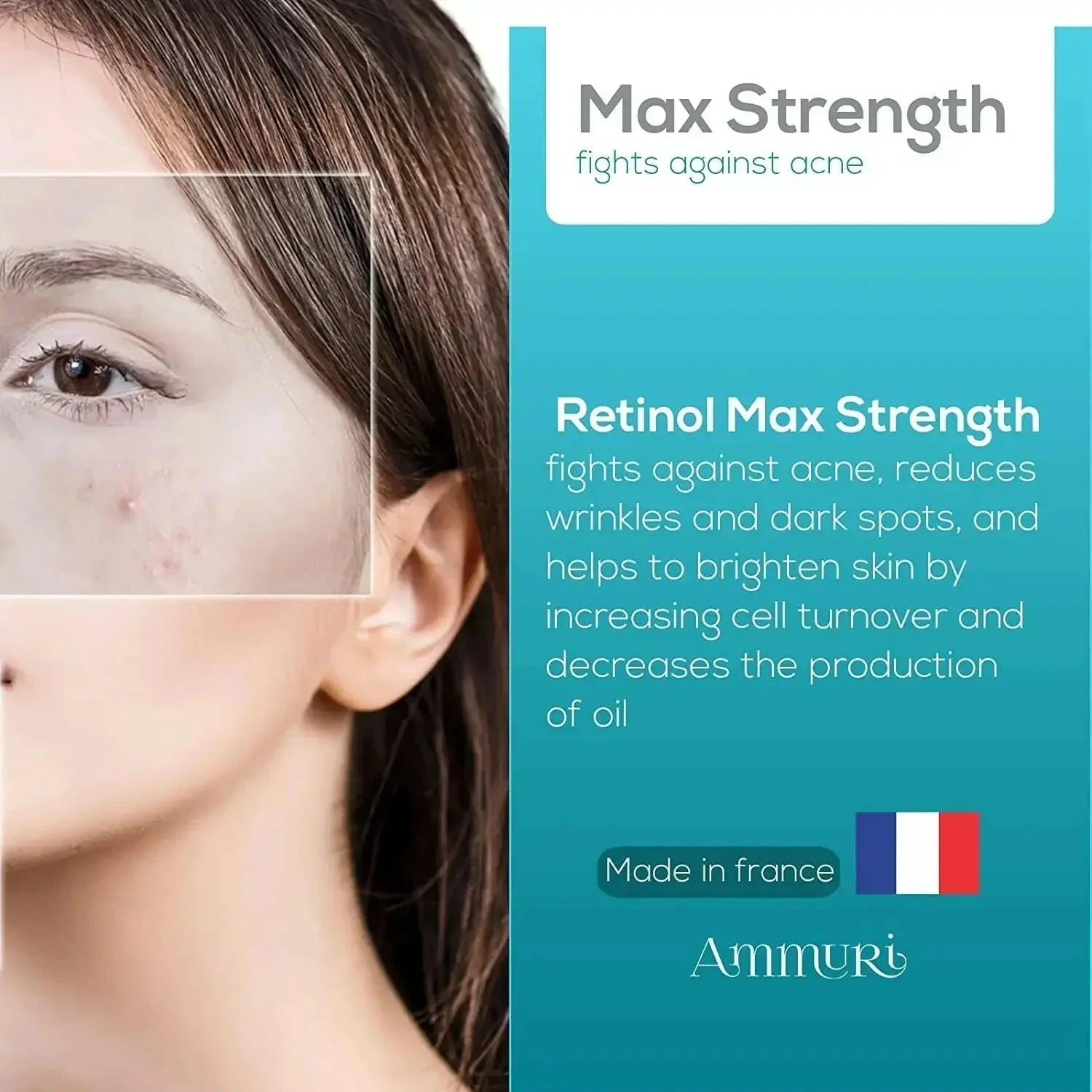 Ammuri Skincare 5% Retinol MAX Powerful Anti - Aging Serum for Youthful Skin - Herbalshire Handmade Herbal Products