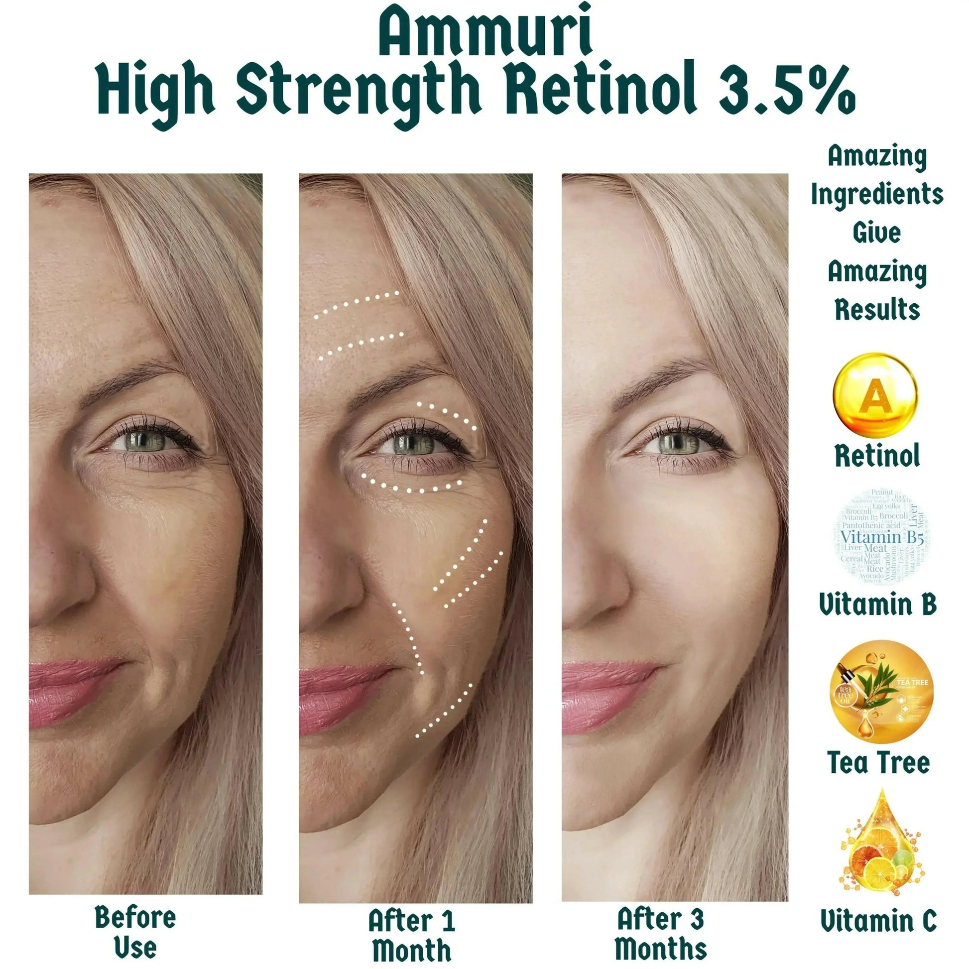 Ammuri Skincare High Strength Retinol Serum - Anti - Aging - Herbalshire Handmade Herbal Products