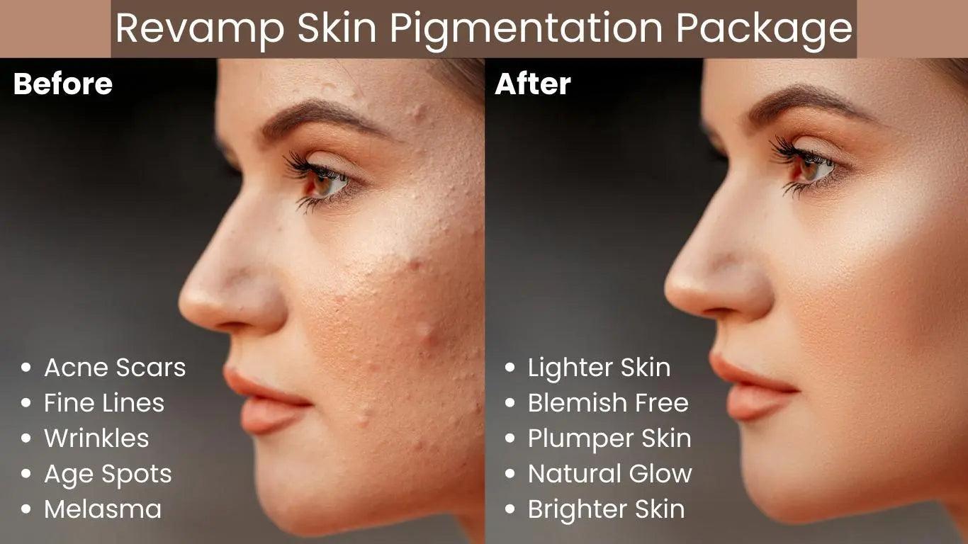 Ammuri Skincare Pigmentation Skincare Gift Set - Herbalshire Handmade Herbal Products