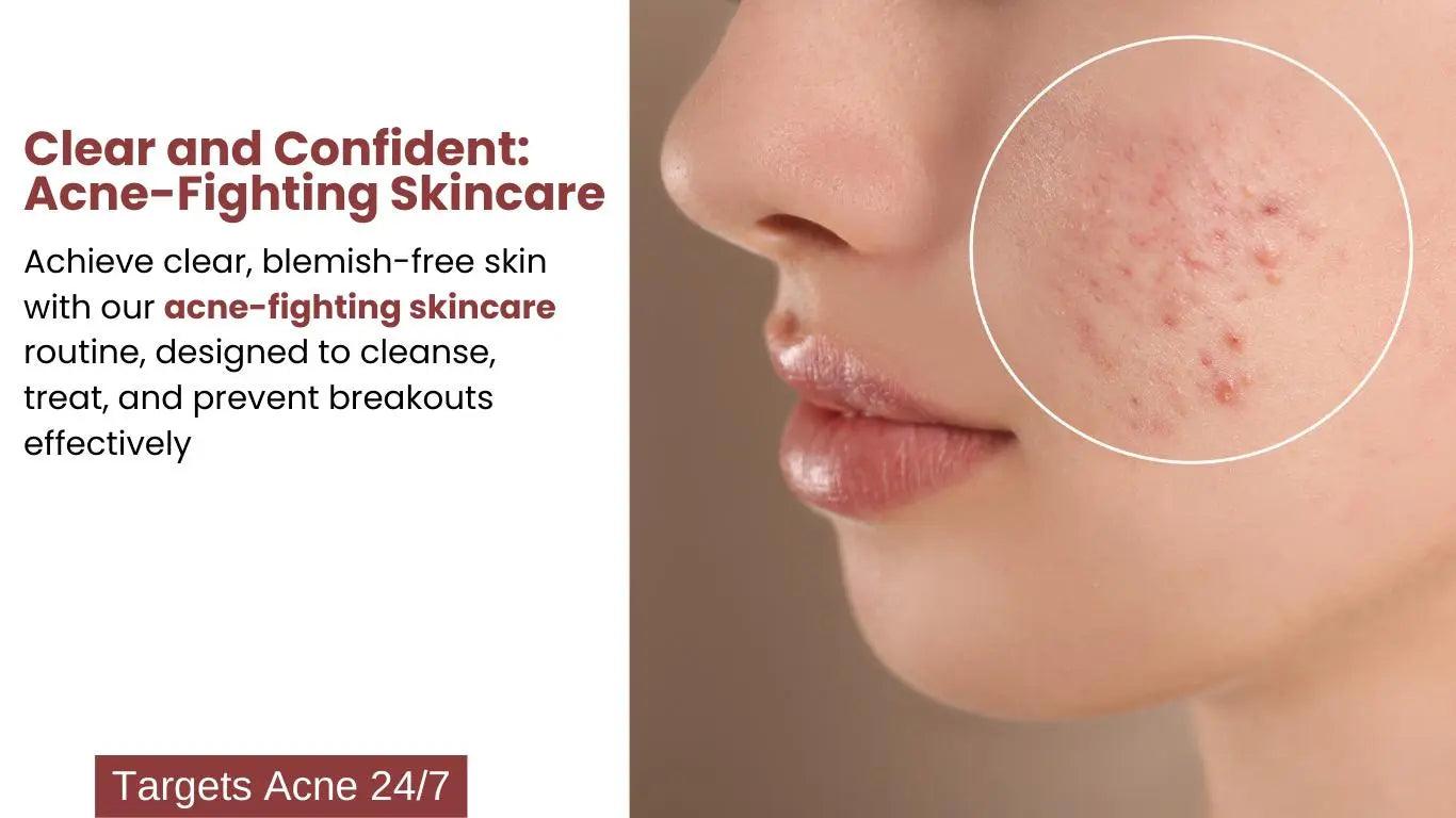 Ammuri Skincare Pigmentation Treatment Skincare Package - Herbalshire Handmade Herbal Products