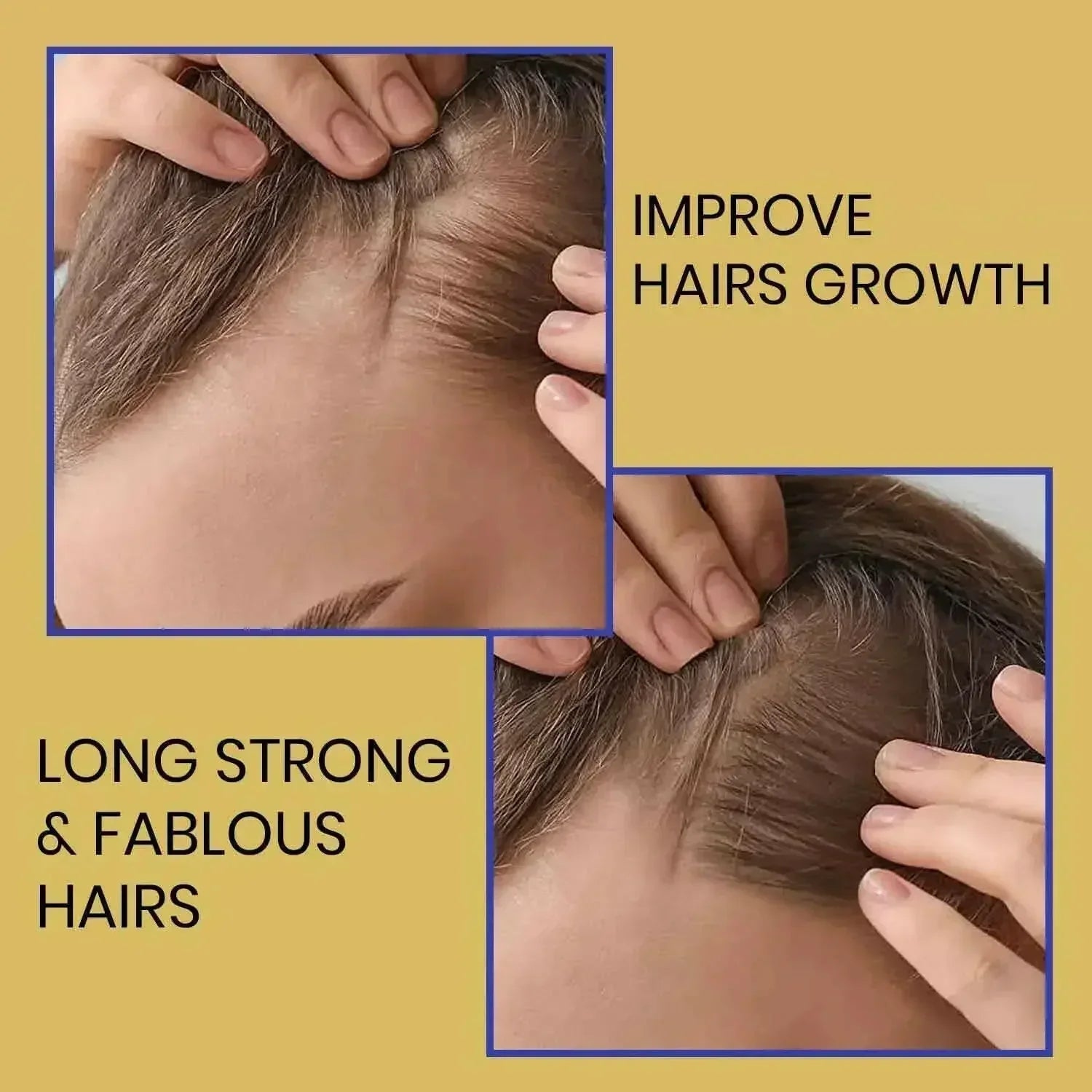 Ammuri Supreme Biotin Shampoo – Daily Hair Care for Thicker - Looking Hair (473ml) - Herbalshire Handmade Herbal Products