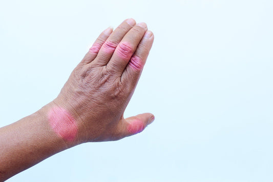Arthritis Rheumatism Ointment Herbal Balm for Joint Care Mobility Support - Herbalshire Handmade Herbal Products