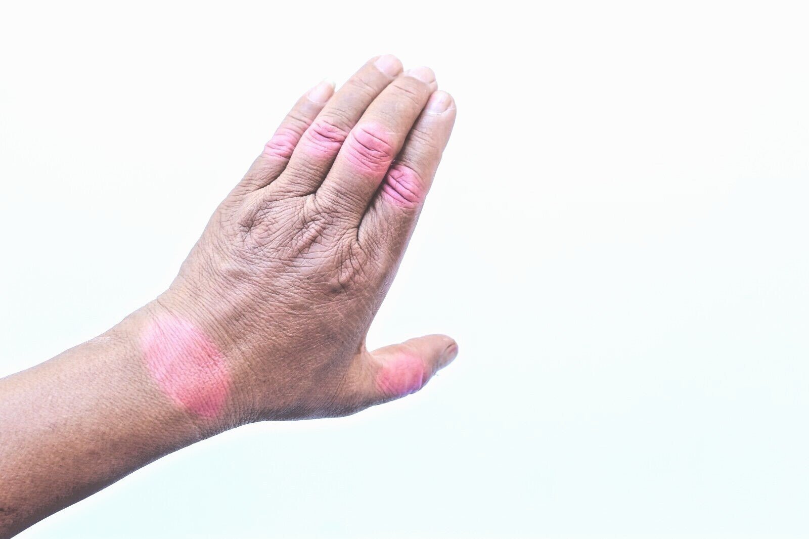 Arthritis & Rheumatism Ointment Reduce Inflammation Enhance Mobility Handmade - Herbalshire Handmade Herbal Products