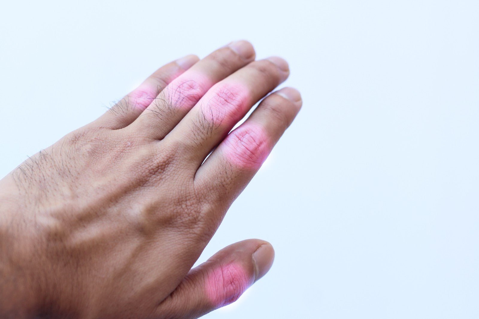 Arthritis & Rheumatism Ointment Reduce Inflammation Enhance Mobility Handmade - Herbalshire Handmade Herbal Products