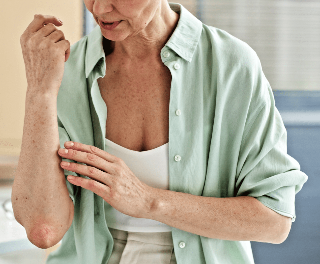 Body Cream for Itchy Skin – Natural Skin Itch Relief Balm Handmade UK - Herbalshire Handmade Herbal Products