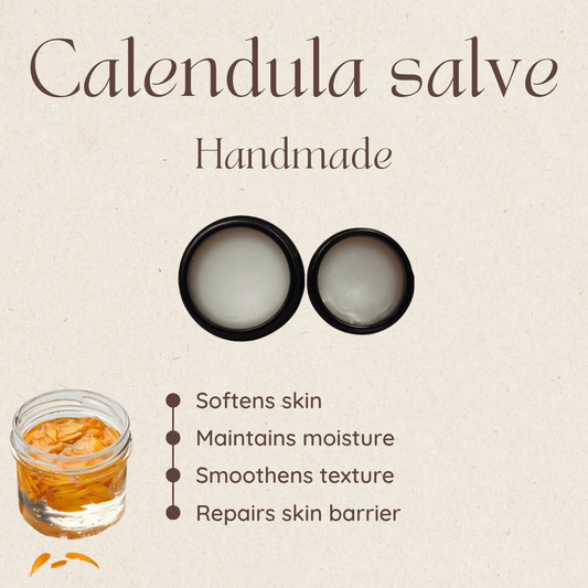 Calendula Cream Ointment Natural Skin Healing Cuts Burns Acne Stretch Marks - Herbalshire Handmade Herbal Products