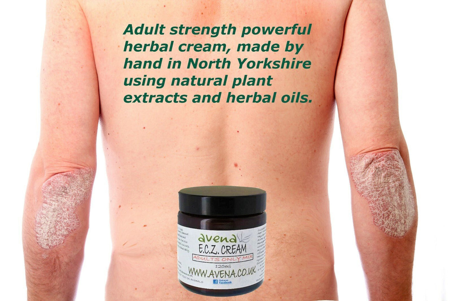 Eczema Cream Adults Ultra Repair Cream Emulsifying Ointment Face Cream Exma - Herbalshire Handmade Herbal Products