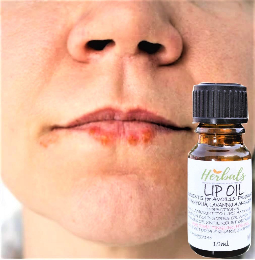 Herbal Lip Oil Lotion for Cold Sore Relief – Soothing Natural Lip Treatment – A - Herbalshire Handmade Herbal Products