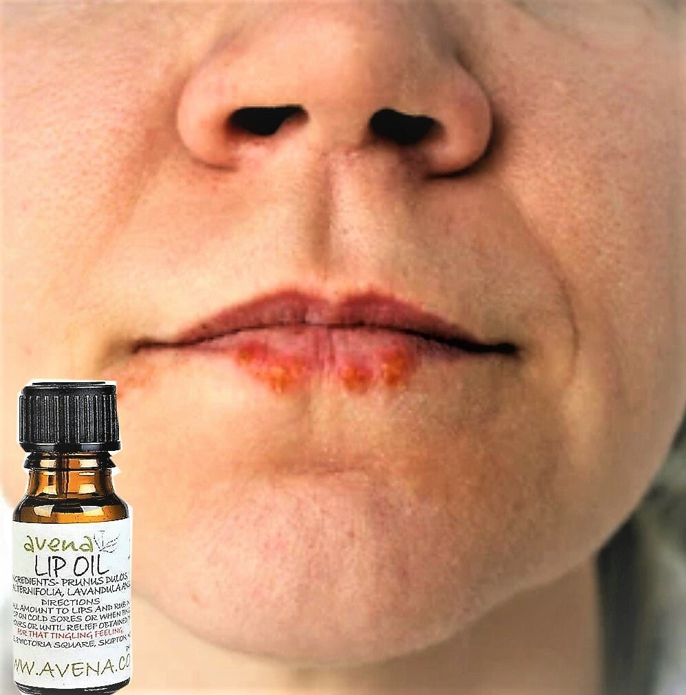 Herbal Lip Oil Lotion Natural Cold Sore Relief - Prevents and Soothes Cold Sores - Herbalshire Handmade Herbal Products