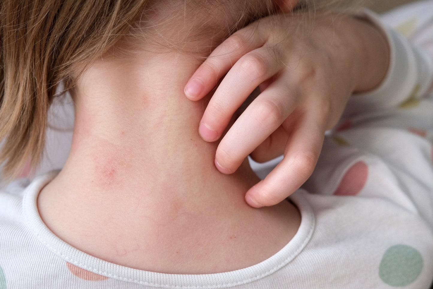 Herbalshire Handmade Itch Relief Salve Natural Soothing Balm for Irritated Skin - Herbalshire Handmade Herbal Products