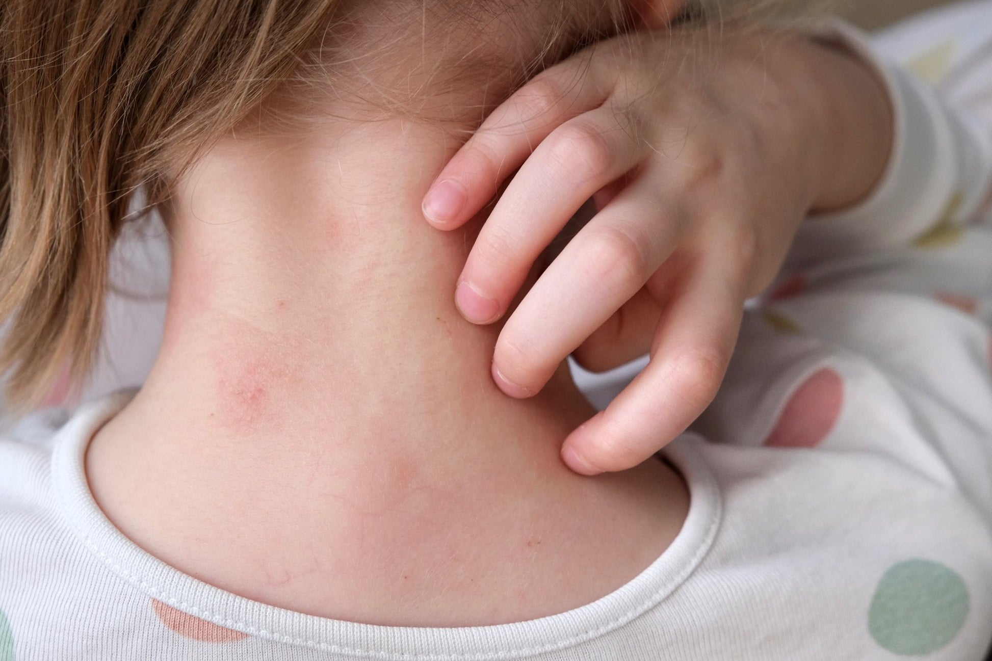 Herbalshire Handmade Itch Relief Salve Natural Soothing Balm for Irritated Skin - Herbalshire Handmade Herbal Products