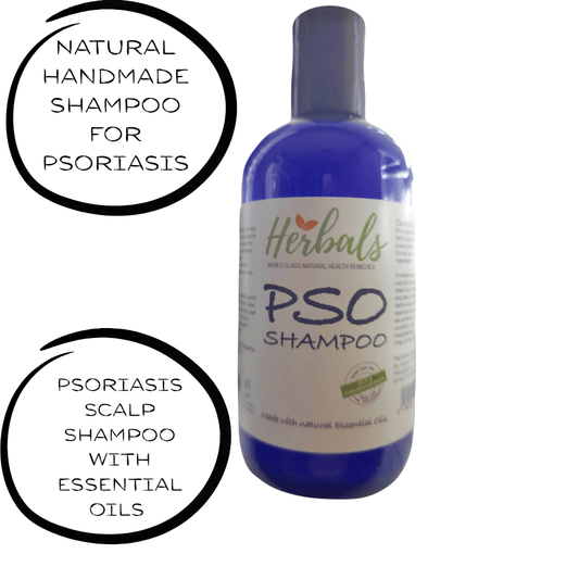 Natural Psoriasis Shampoo – Handmade Relief for Dry, Flaky, Itchy Scalp – 250ml - Herbalshire Handmade Herbal Products