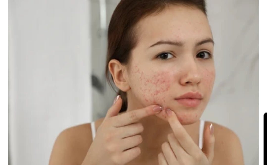 Neem Oil and Lemongrass Soap 200g Natural - Natural Cleansing with a Refreshing - Herbalshire Handmade Herbal Products