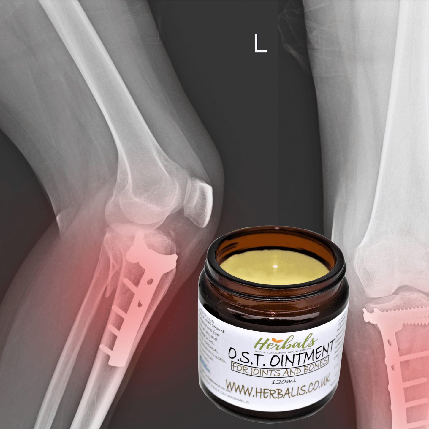 Osteoarthritis Cream Joint Knee Hip Fingers Pain Relief Fibromyalgia Flare Up - Herbalshire Handmade Herbal Products