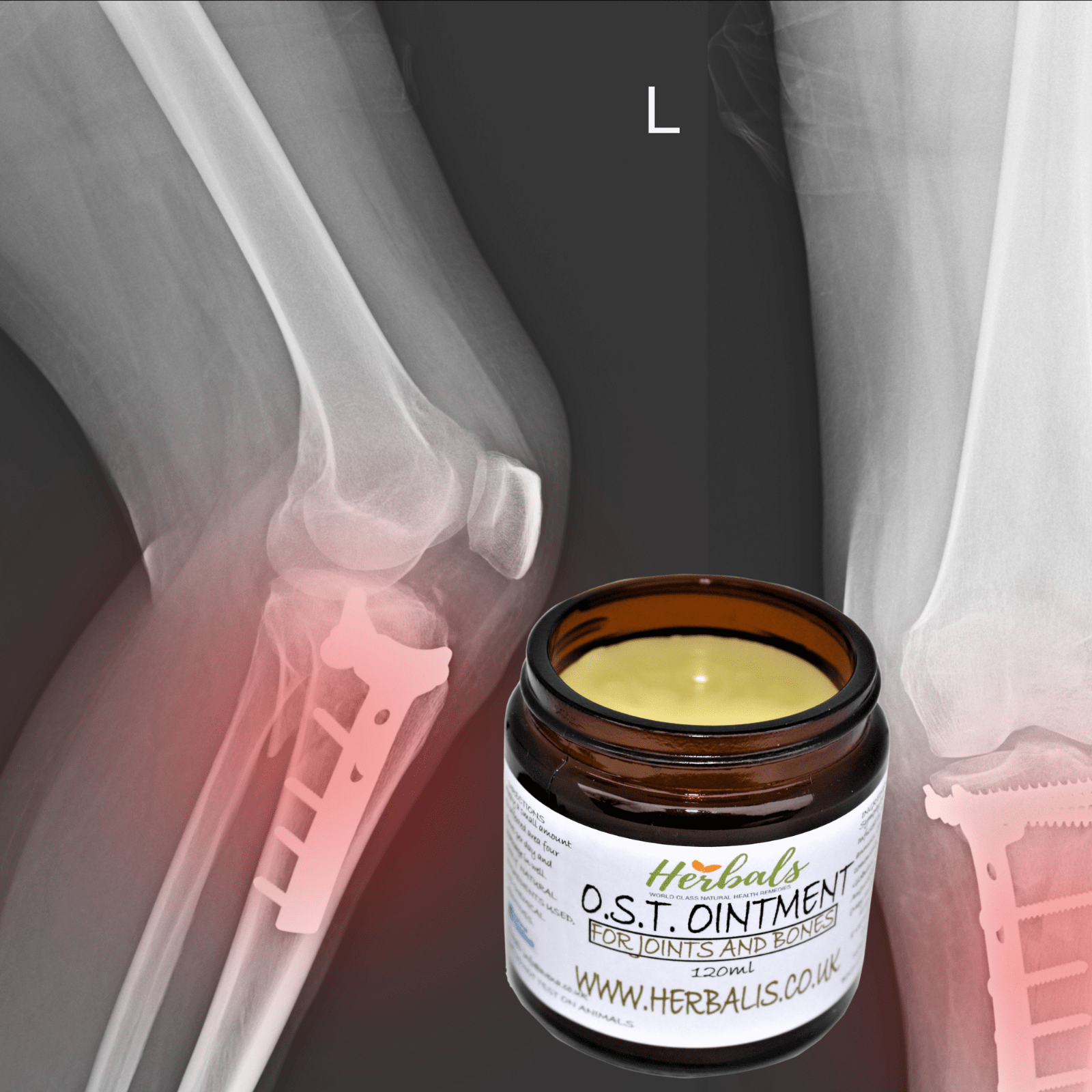 Osteoarthritis Cream Joint Knee Hip Fingers Pain Relief Fibromyalgia Flare Up - Herbalshire Handmade Herbal Products