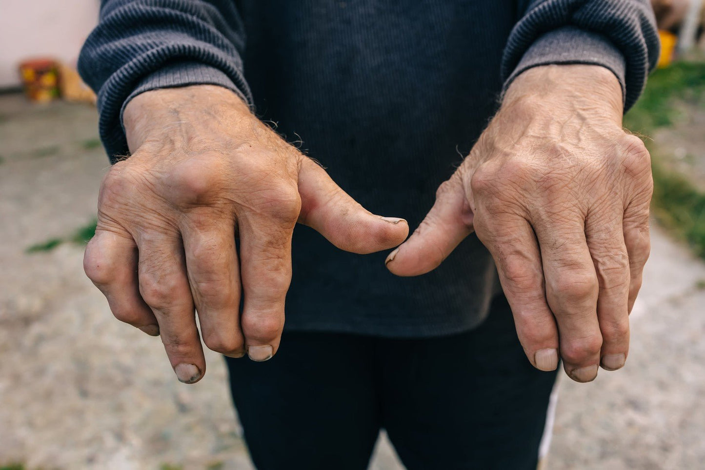 Osteoarthritis Massage Natural Oil 100ml 250ml 500ml —Relieve Joint Pain with H - Herbalshire Handmade Herbal Products