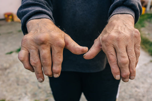 Osteoarthritis Massage Natural Oil 100ml 250ml 500ml —Relieve Joint Pain with H - Herbalshire Handmade Herbal Products