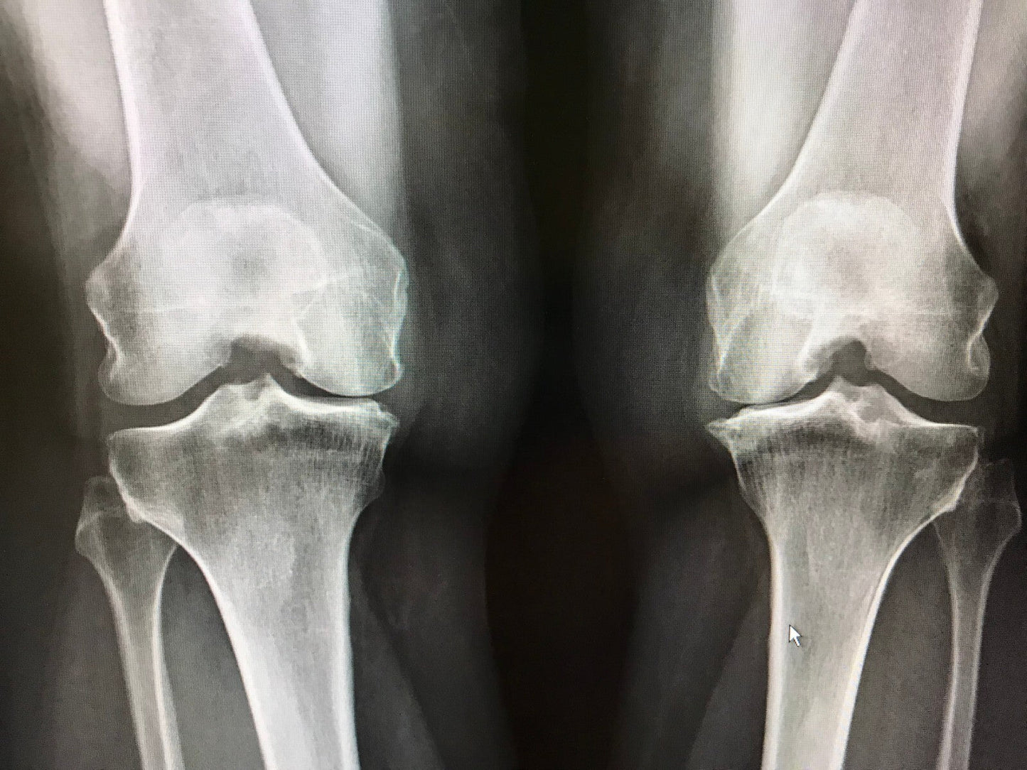 Osteoarthritis Pain Relief Cream Joint Balm for Knee Hip Spine Hands UK - Herbalshire Handmade Herbal Products