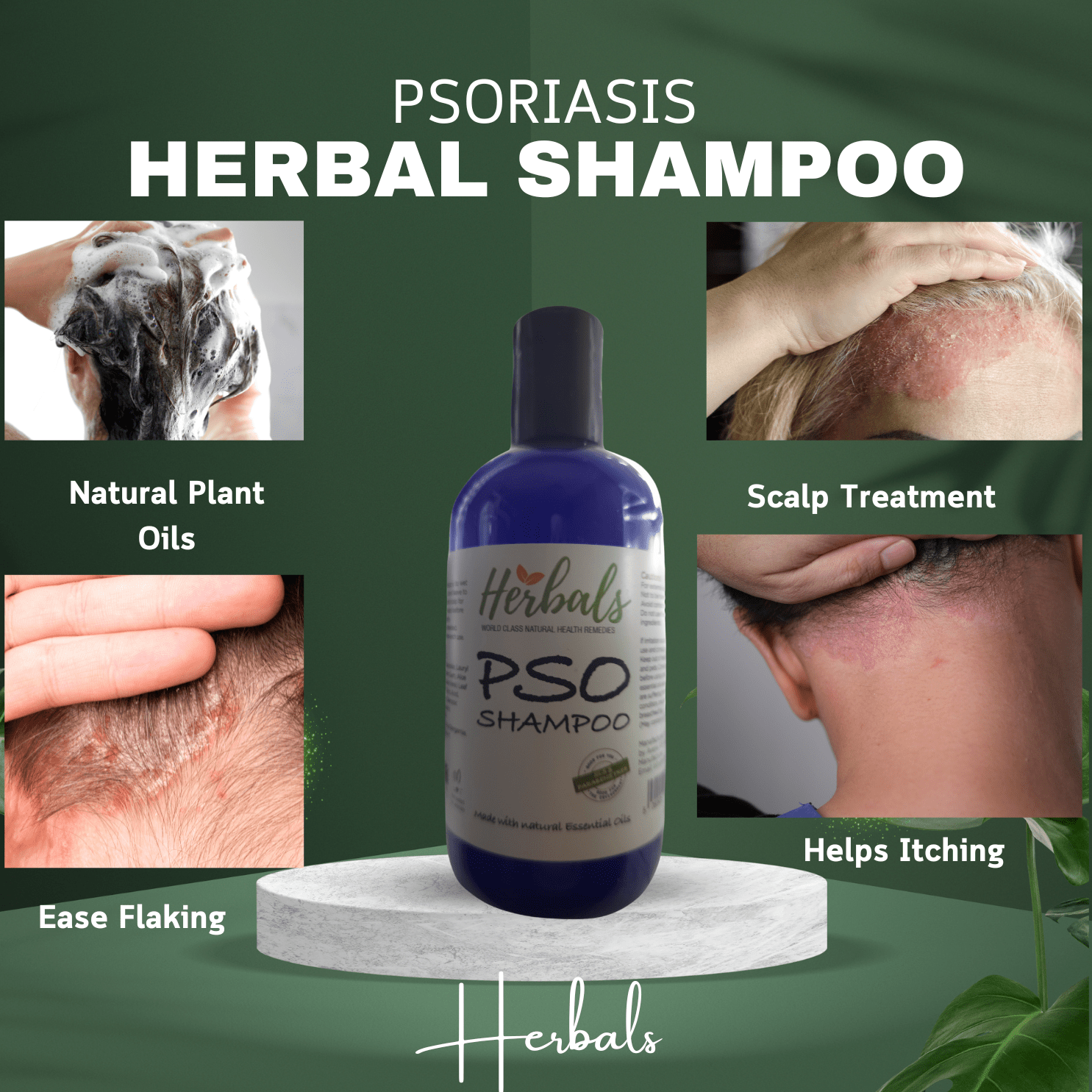 PSO Herbal Scalp Care Shampoo - Effective Dandruff Treatment & Soothing Psoriasis Relief - Herbalshire Handmade Herbal Products