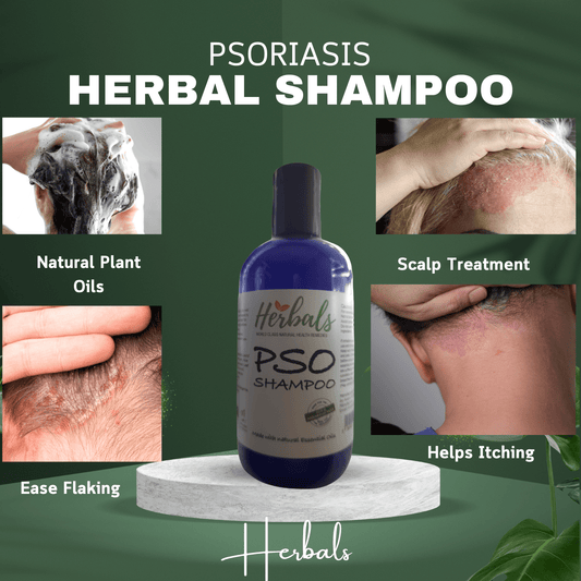 PSO Herbal Scalp Care Shampoo - Effective Dandruff Treatment & Soothing Psoriasis Relief - Herbalshire Handmade Herbal Products